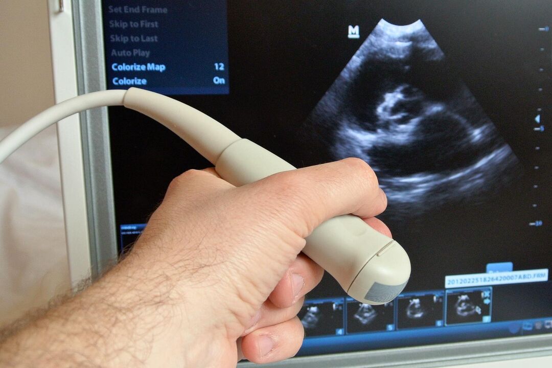 Ultrasound akan membantu mendiagnosis prostatitis kongestif pada seorang lelaki